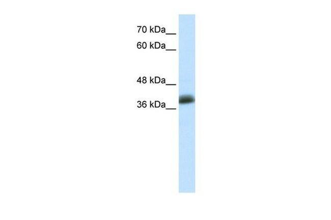 SAP30BP Antibody in Western Blot (WB)