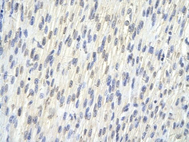 SAP30BP Antibody in Immunohistochemistry (Paraffin) (IHC (P))