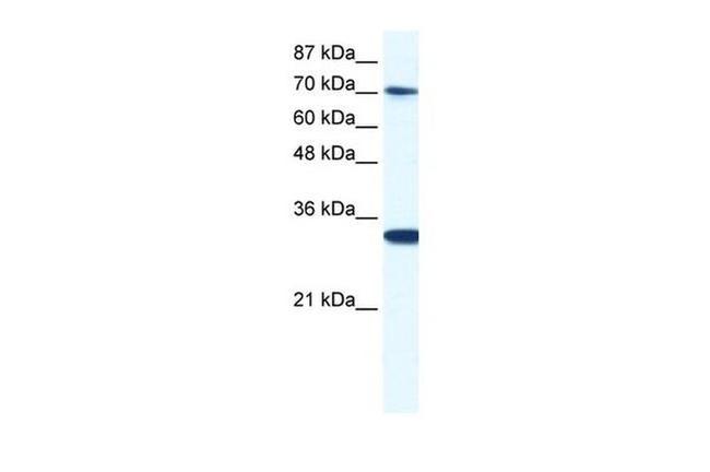 CNOT3 Antibody in Western Blot (WB)