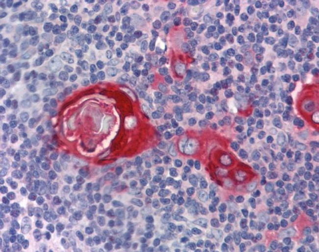 ZFP36 Antibody in Immunohistochemistry (IHC)