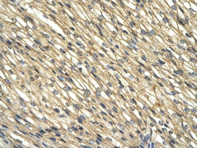 WDR39 Antibody in Immunohistochemistry (Paraffin) (IHC (P))