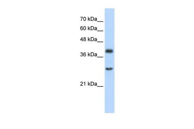 WDR39 Antibody in Western Blot (WB)