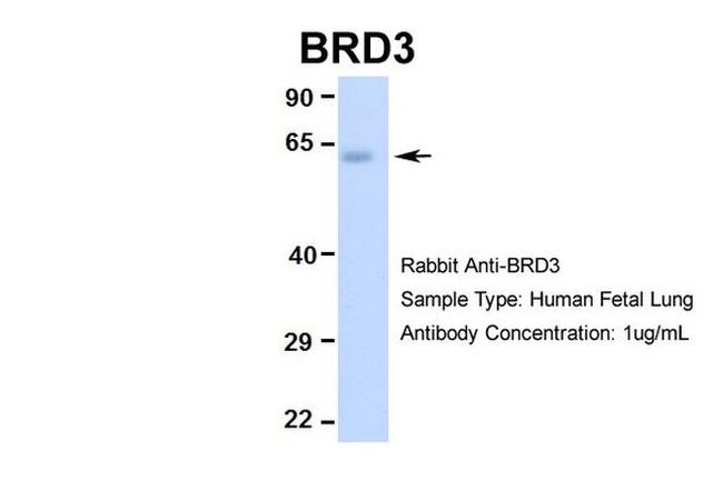 BRD3 Antibody in Western Blot (WB)