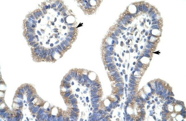 IkB beta Antibody in Immunohistochemistry (IHC)