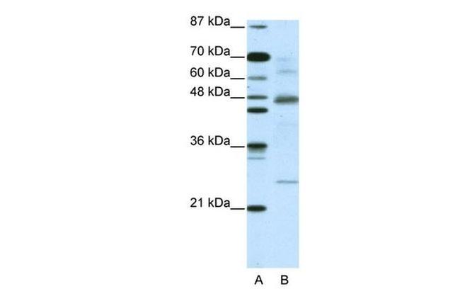 IkB beta Antibody in Western Blot (WB)