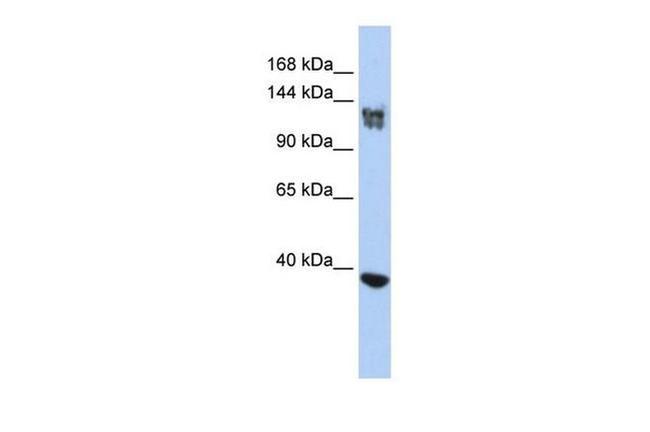 SMARCA1 Antibody in Western Blot (WB)