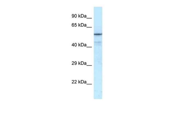 NRF1 Antibody in Western Blot (WB)