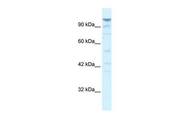 LARP2 Antibody in Western Blot (WB)