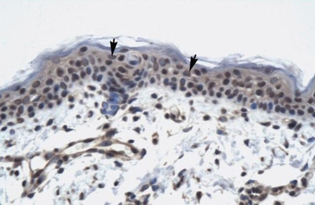 TAF9 Antibody in Immunohistochemistry (IHC)