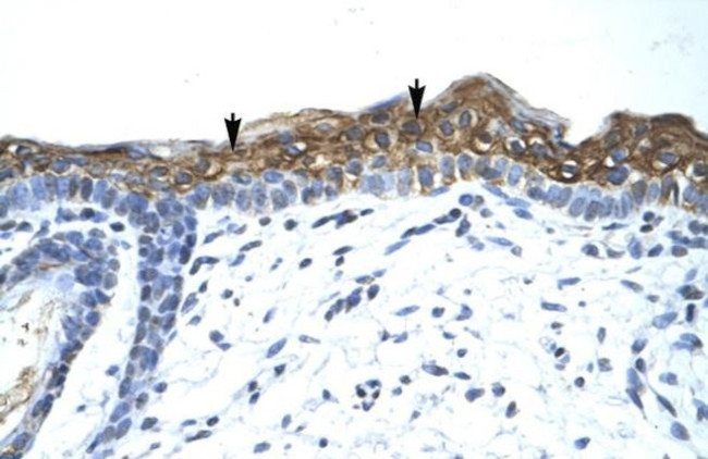 SUV420H1 Antibody in Immunohistochemistry (Paraffin) (IHC (P))