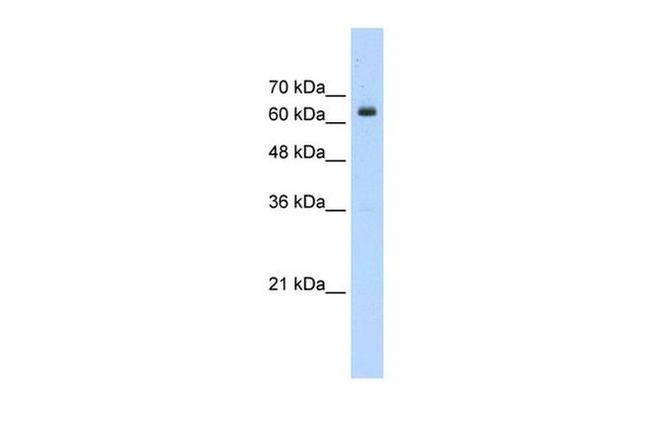 NACC2 Antibody in Western Blot (WB)