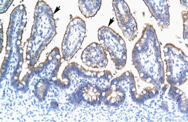 TRIM15 Antibody in Immunohistochemistry (IHC)