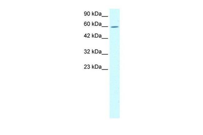 TRIM15 Antibody in Western Blot (WB)