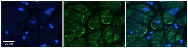 ASPH Antibody in Immunohistochemistry (Paraffin) (IHC (P))