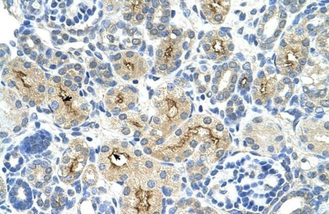 TAF6 Antibody in Immunohistochemistry (IHC)