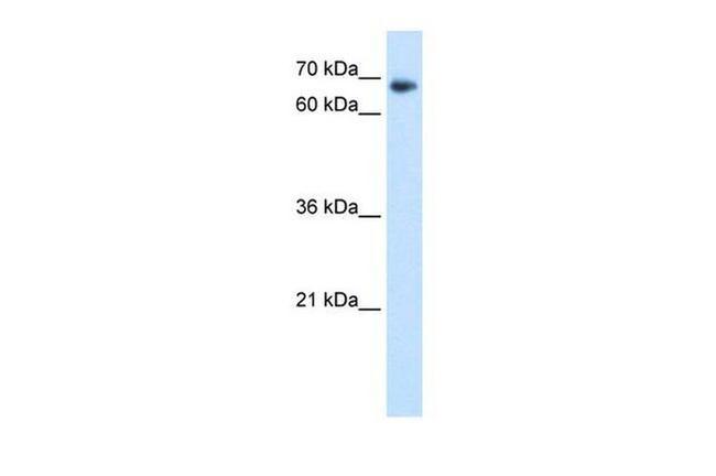 TAF6 Antibody in Western Blot (WB)