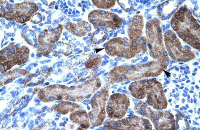TRIM31 Antibody in Immunohistochemistry (IHC)