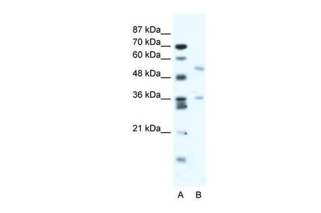 BTBD3 Antibody in Western Blot (WB)