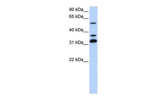 TRIM9 Antibody in Western Blot (WB)