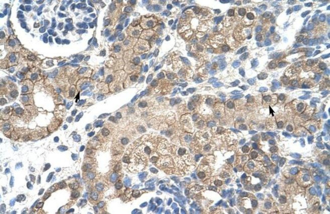 CHRNB2 Antibody in Immunohistochemistry (IHC)