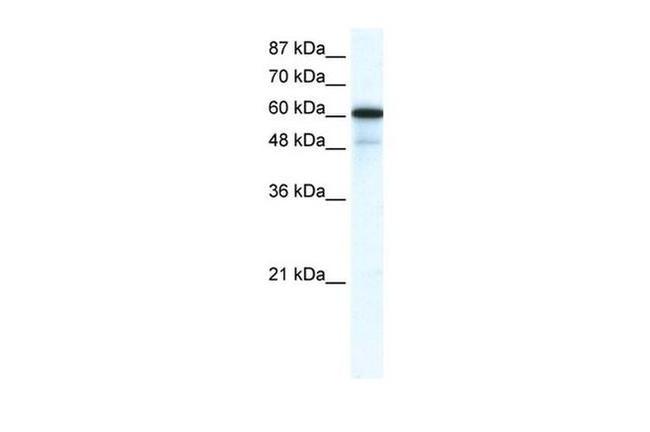 GABRA1 Antibody in Western Blot (WB)