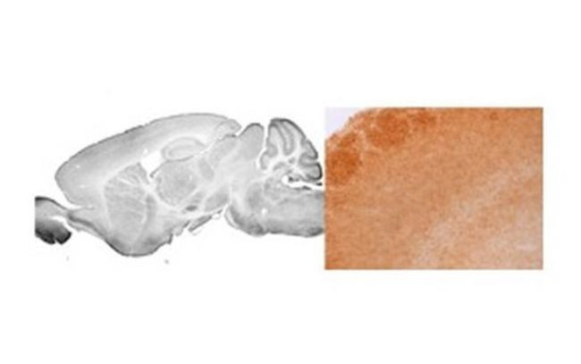 GABRA3 Antibody in Immunohistochemistry (IHC)