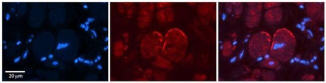 NMDAR2C Antibody in Immunohistochemistry (Paraffin) (IHC (P))