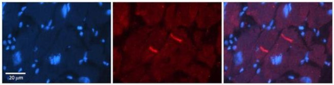 GABRR2 Antibody in Immunohistochemistry (Paraffin) (IHC (P))