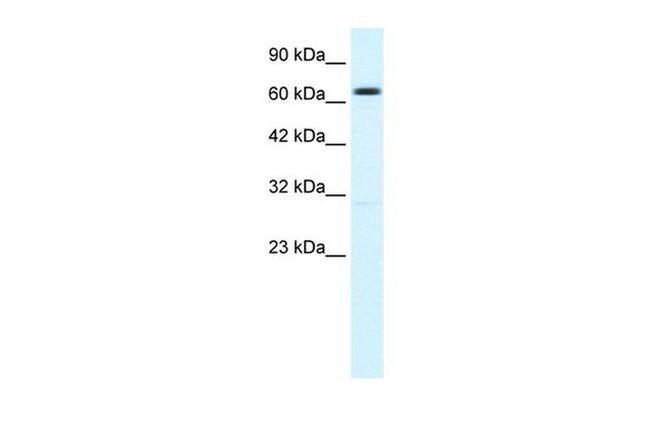 KCNN2 Antibody in Western Blot (WB)