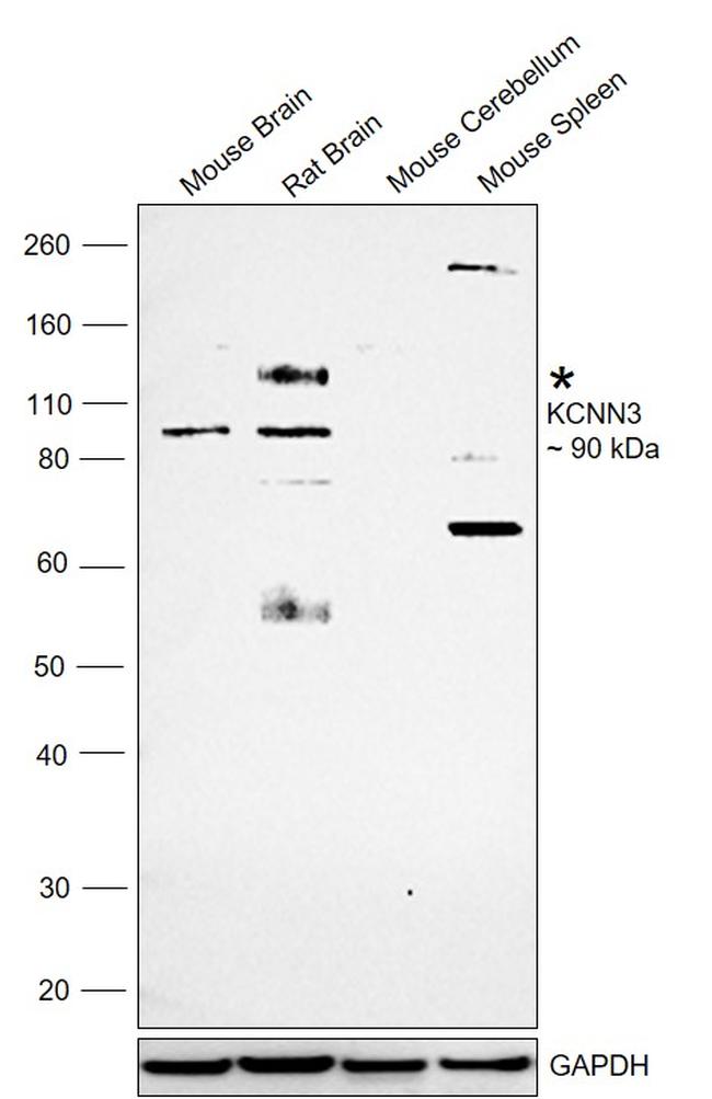 KCNN3 Antibody in Western Blot (WB)