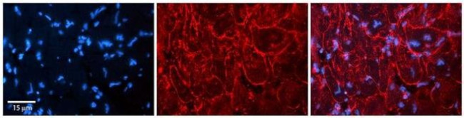 KCNN3 Antibody in Immunohistochemistry (Paraffin) (IHC (P))