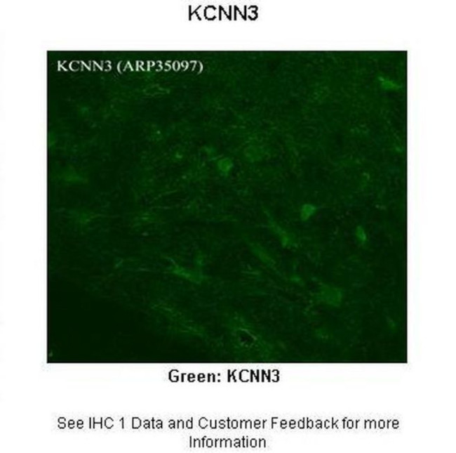 KCNN3 Antibody in Immunohistochemistry (Paraffin) (IHC (P))