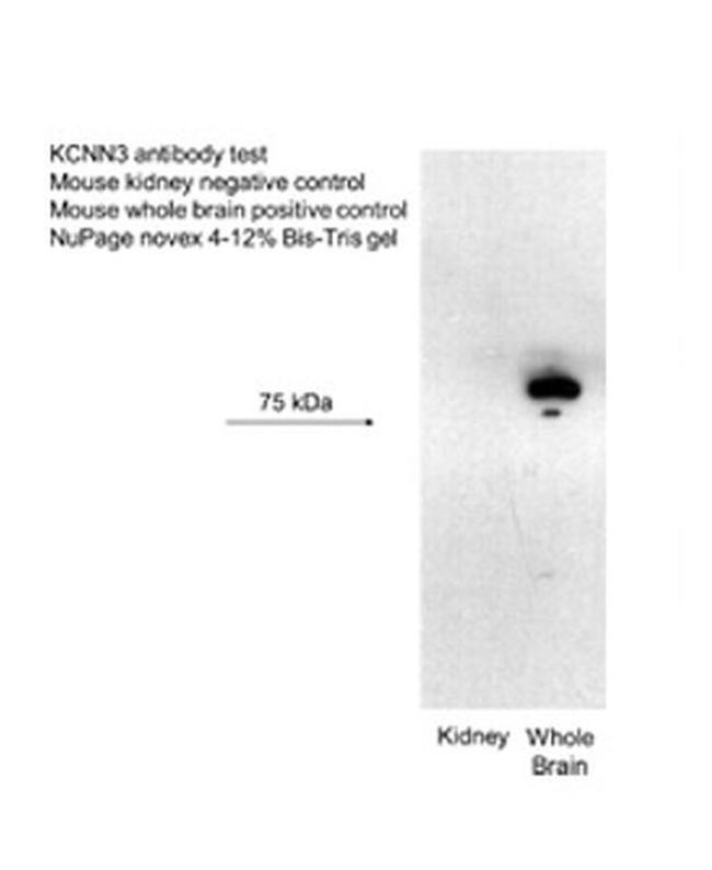 KCNN3 Antibody in Western Blot (WB)