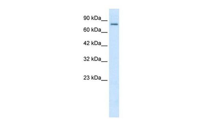 KCNN3 Antibody in Western Blot (WB)