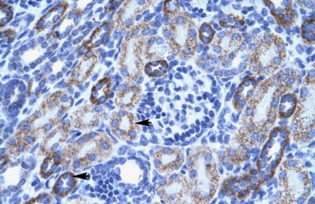 ASIC3 Antibody in Immunohistochemistry (IHC)