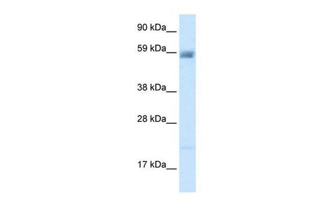 ASIC3 Antibody in Western Blot (WB)