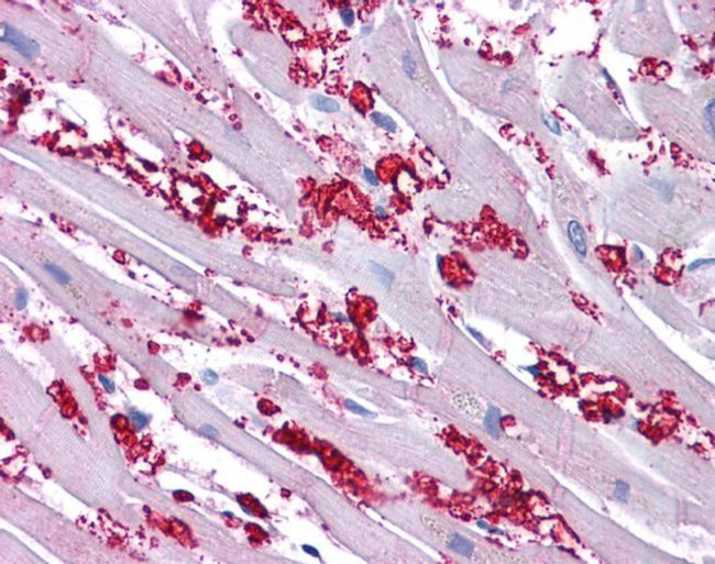 KV1.8 (KCNA10) Antibody in Immunohistochemistry (IHC)