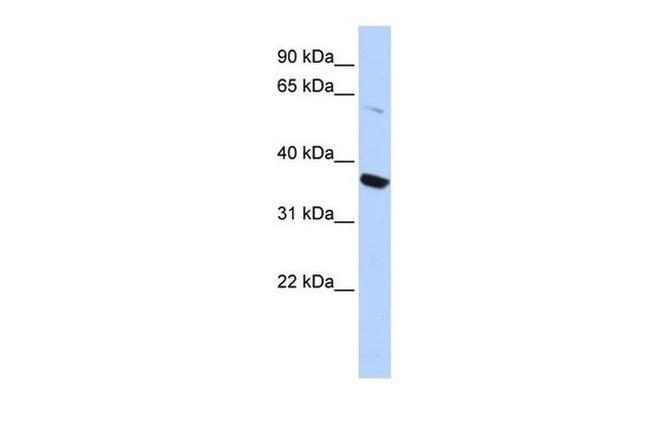 KV1.8 (KCNA10) Antibody in Western Blot (WB)