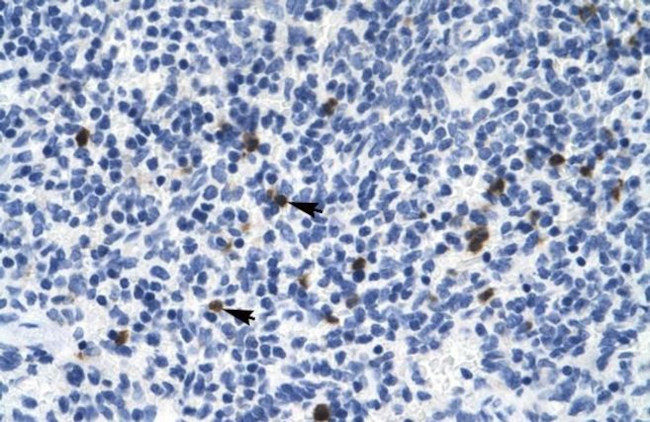 HTR3B Antibody in Immunohistochemistry (Paraffin) (IHC (P))