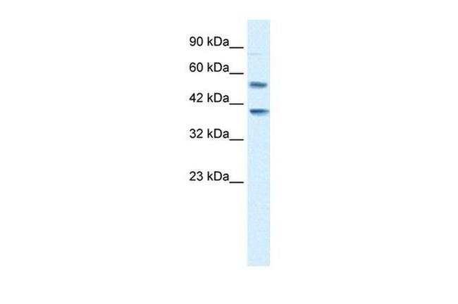 HTR3B Antibody in Western Blot (WB)