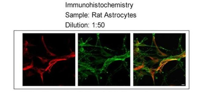 MLC1 Antibody in Immunohistochemistry (IHC)