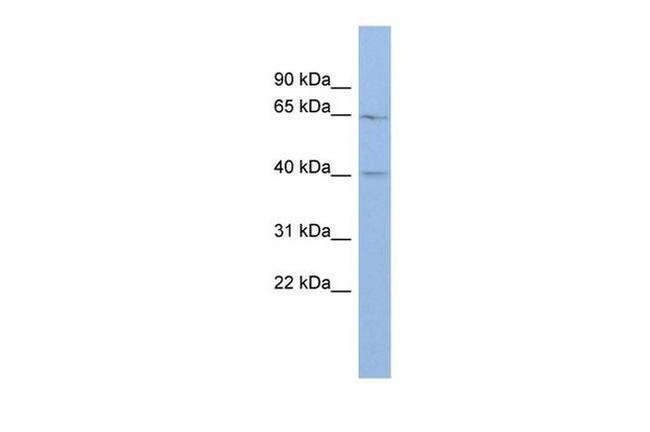 MLC1 Antibody in Western Blot (WB)