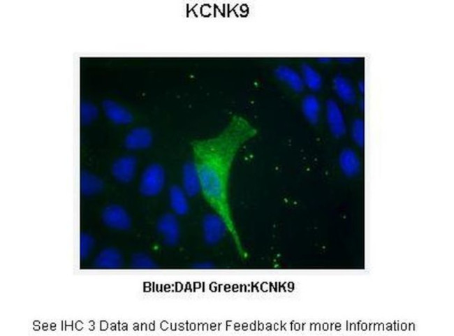 KCNK9 Antibody in Immunocytochemistry (ICC/IF)