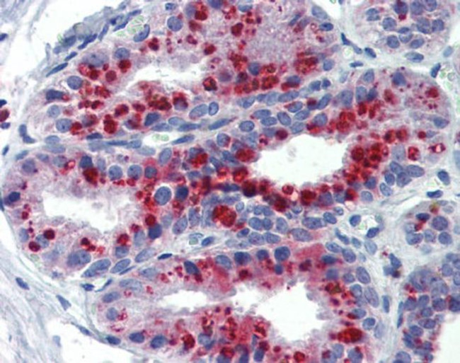 KCNK9 Antibody in Immunohistochemistry (IHC)