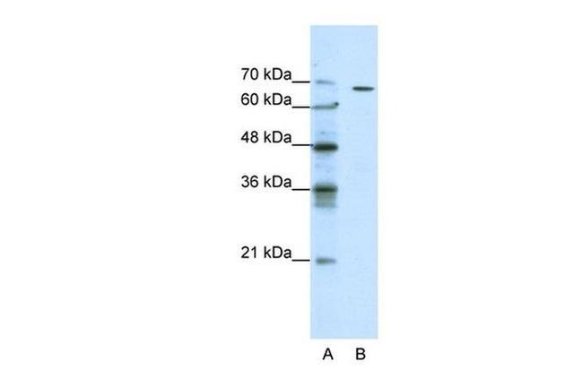 GABRQ Antibody in Western Blot (WB)