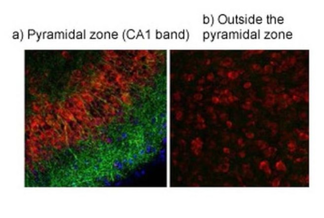 TRPV4 Antibody in Immunohistochemistry (IHC)