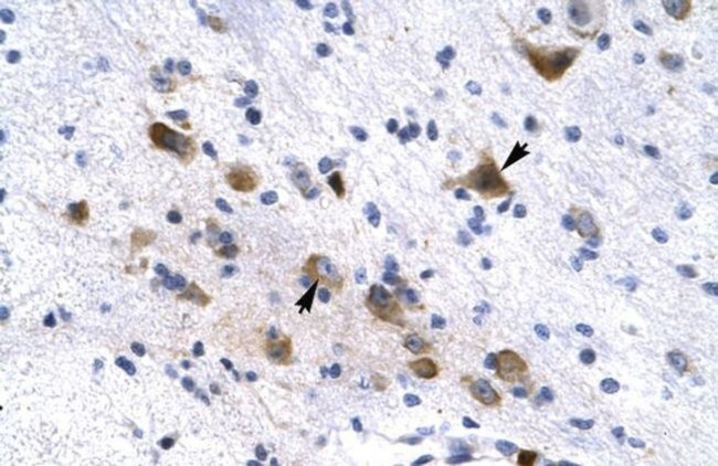 KCNH6 Antibody in Immunohistochemistry (IHC)