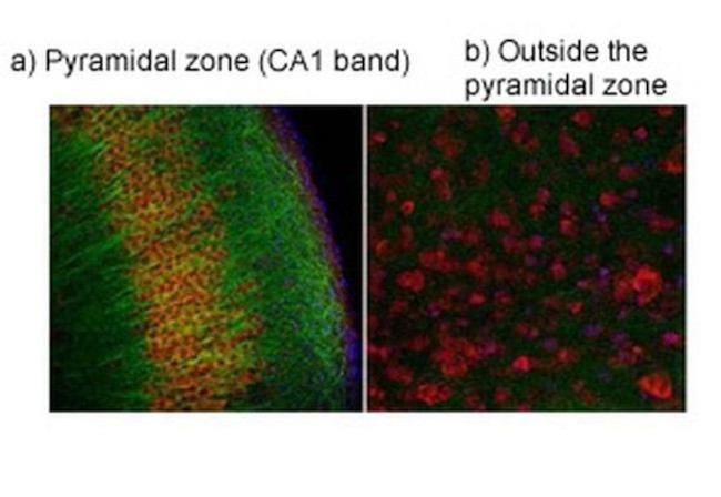 TRPV4 Antibody in Immunohistochemistry (IHC)