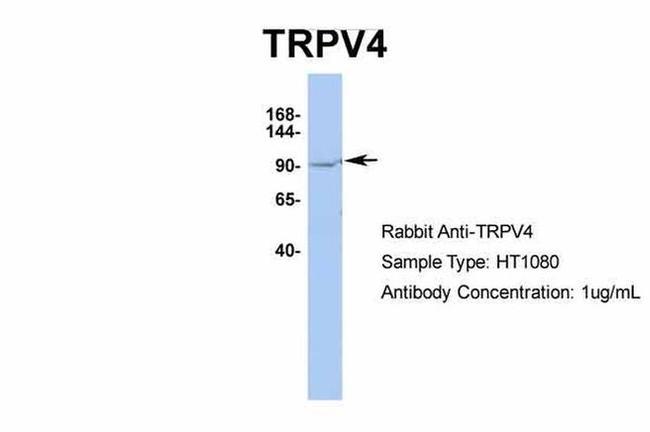 TRPV4 Antibody in Western Blot (WB)