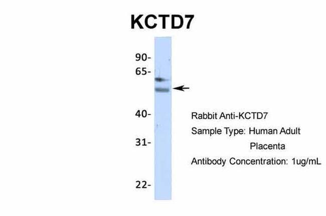 KCTD7 Antibody in Western Blot (WB)